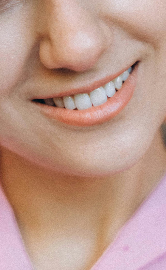 Signature Dental Aesthetics woman smiling with visible teeth