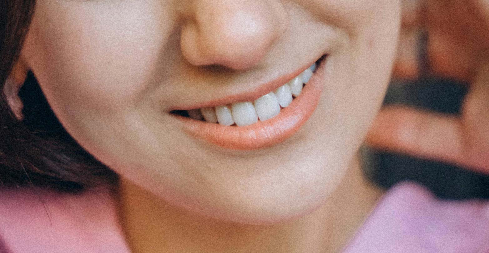 Signature Dental Aesthetics woman smiling with visible teeth